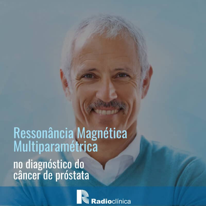 Ressonância Magnética Multiparamétrica No Diagnóstico Do Câncer De Próstata Radioclínica 2677