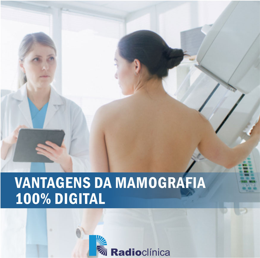 Vantagens da Mamografia 100% Digital | Radioclínica
