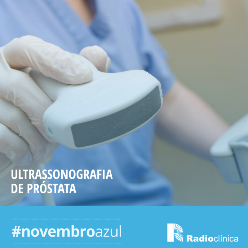 Ultrassonografia De Próstata Radioclínica Clínica De Imagem 3659