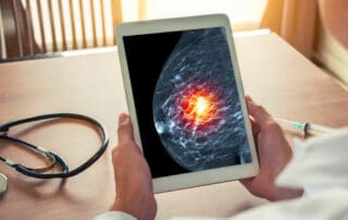 Biópsia de mama: conheça as principais indicações da mamotomia!