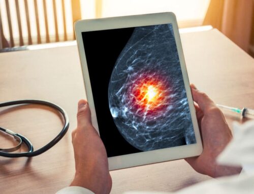Biópsia de mama: principais indicações da mamotomia!