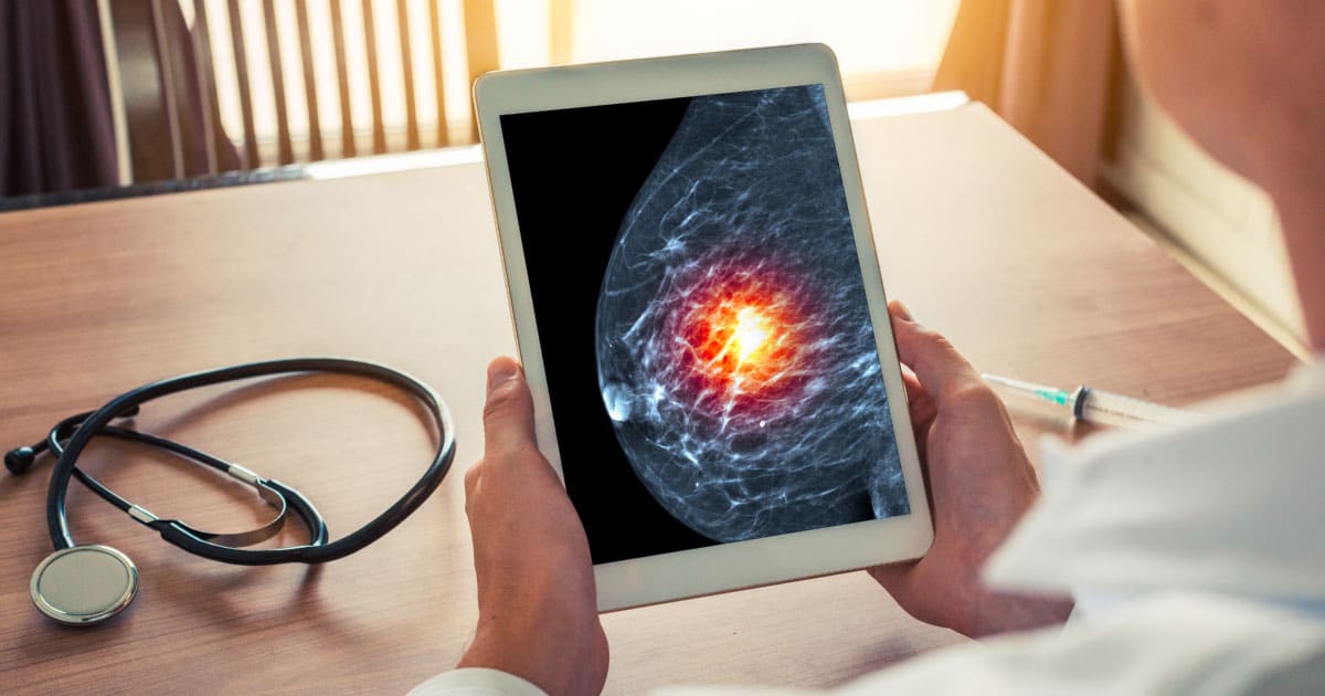 Biópsia de mama: conheça as principais indicações da mamotomia!